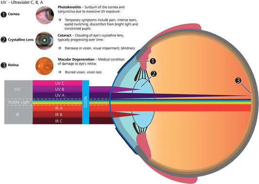 Ultraviolet Radiation ad Your Eyes